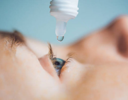 Closeup of eyedropper putting liquid into open eye.